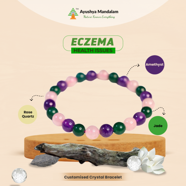 Skin Healing Crystal Bracelet for Eczema